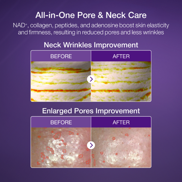 Numbuzin - No.9 Nad Bio Lifting Full Cover Sheet 1pc